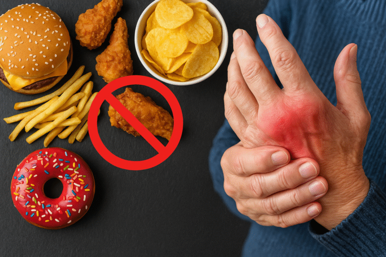 Foods to Avoid If You Have Arthritis